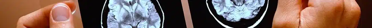 neurology-banner-sliver