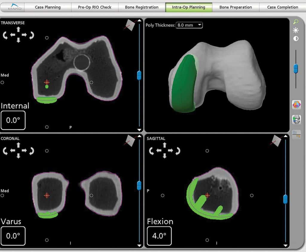 Sample imaging from Mako