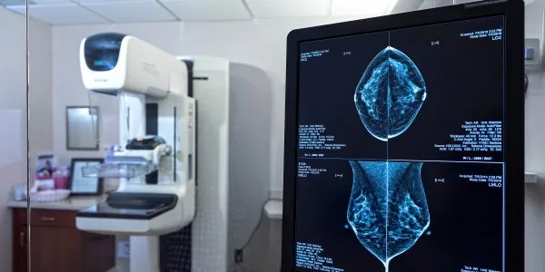 $85 mammograms during the month of October