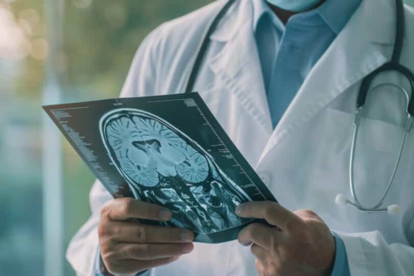 MRI