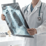 Pulmonology Doctor  X-Ray 1x1