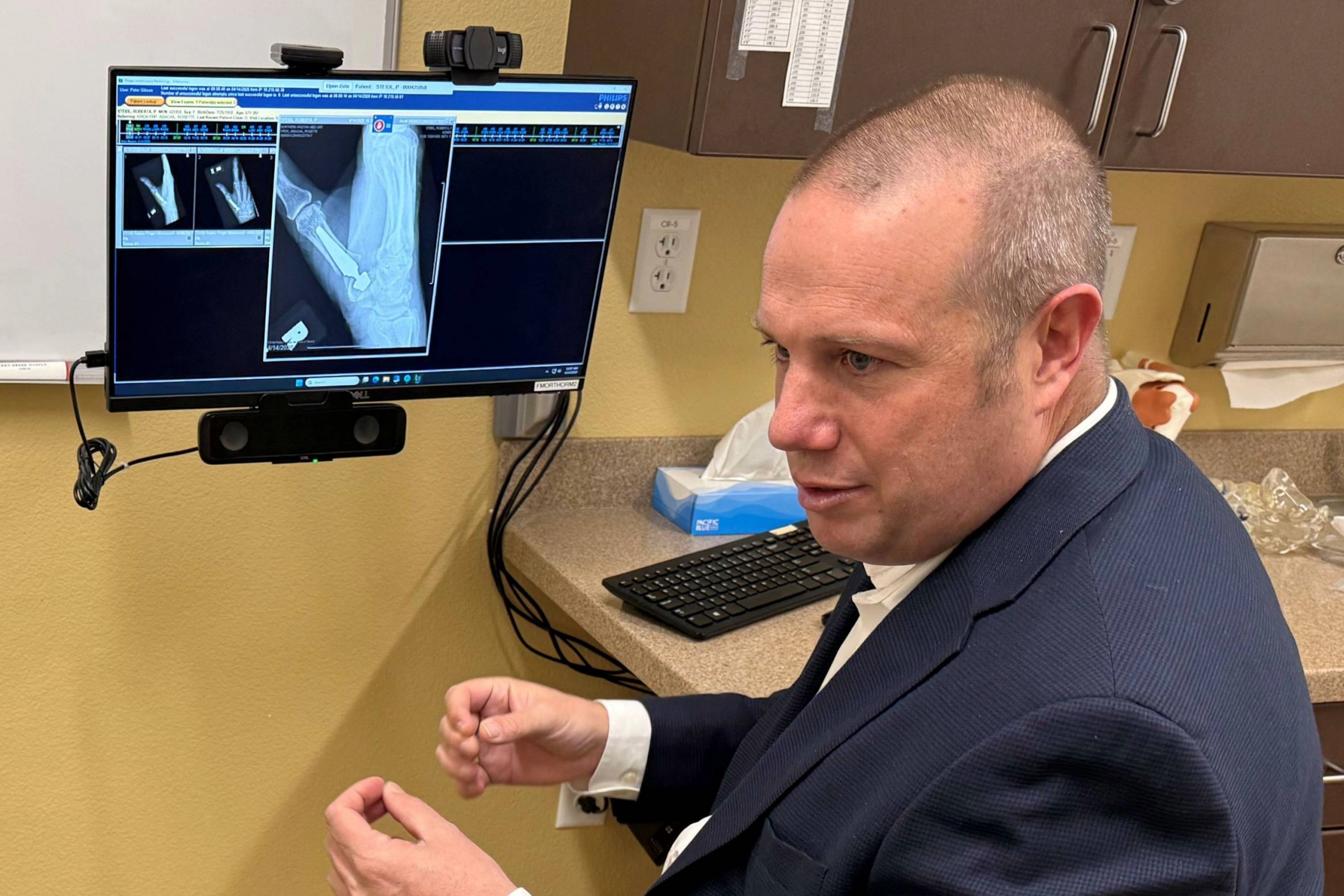 NAH completes Arizona’s first TOUCH® CMC 1 Thumb Prosthesis implant 