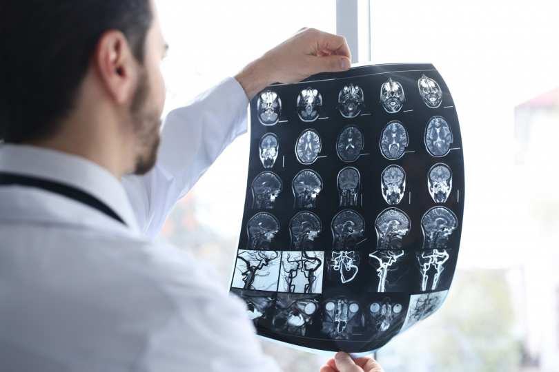 Community Health Matters Brain Scan 3x2